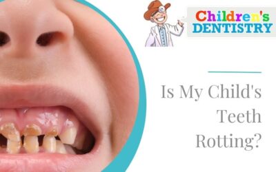 Are My Child’s Teeth Rotting?