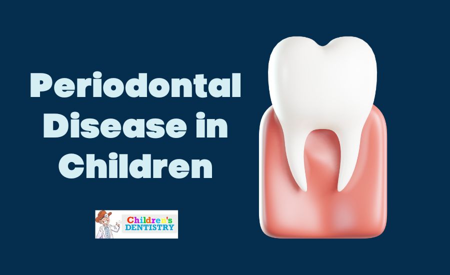 Periodontal Disease in Children